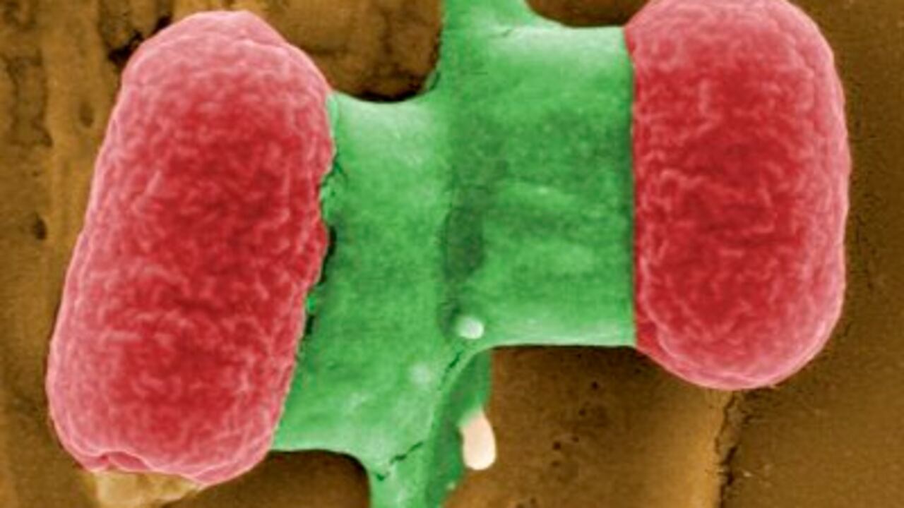 Imagen tomada mediante un microscopio electrónico una bacteria EHEC, una cepa de la bacteria Escherichia coli de alta resistencia a los antibióticos.