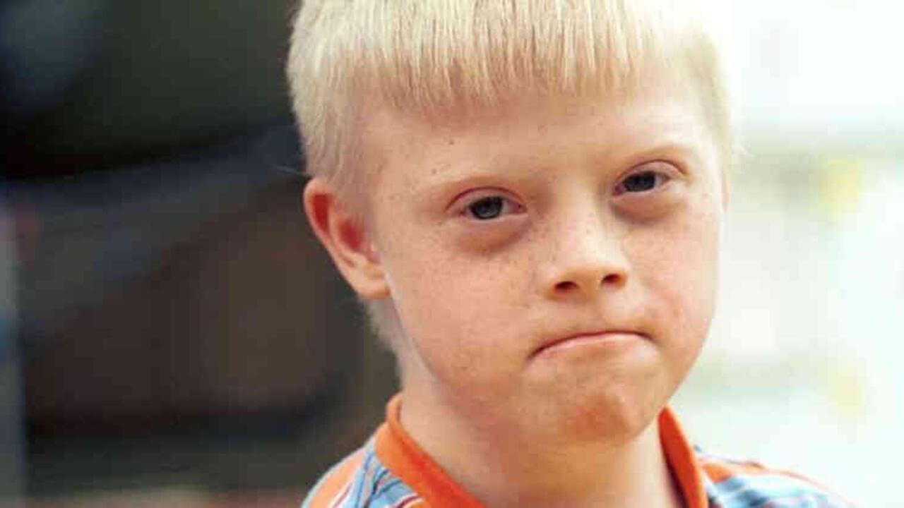 Estudios como la amniocentesis pueden detectar el síndrome de Down con exactitud, pero presentan riesgos para la salud del bebé por ser invasivos.