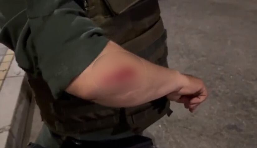 Los uniformados sufrieron heridas en los brazos.