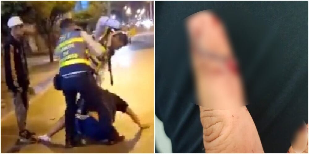 Uno de los agentes de tránsito dijo que el ciudadano le mordió un dedo.