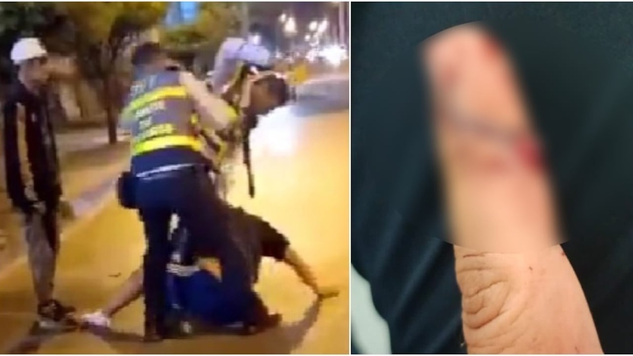 Uno de los agentes de tránsito dijo que el ciudadano le mordió un dedo.