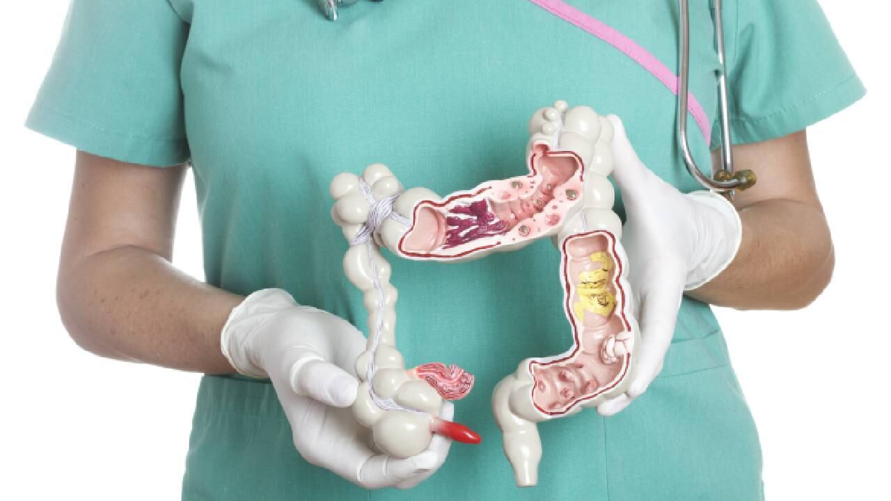 Comer fibra y evitar el gluten, son algunas recomendaciones para evitar el síndrome de intestino irritable.