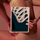 Imagen de referencia radiografía de huesos. Foto: Getty Images.