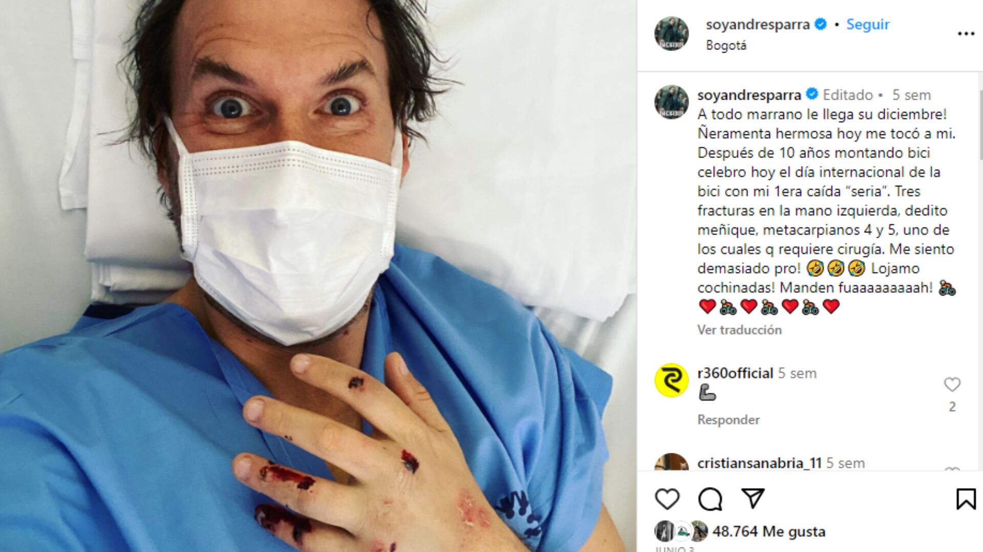 Andrés Parra tras sufrir accidente en su bicicleta