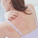 infecciones cutáneas