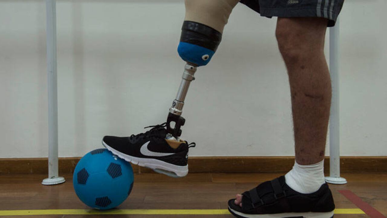 Con el cuerpo todavía lleno de cicatrices y la movilidad dolorida tras varias operaciones en 56 días de internamiento, Follmann aguarda las instrucciones del doctor José André Carvalho en el centro de rehabilitación de Sao Paulo, donde reconquista su autonomía.