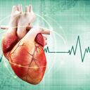 Según cifras del Ministerio de Salud, en el país mueren a diario alrededor de 150 personas por infartos.