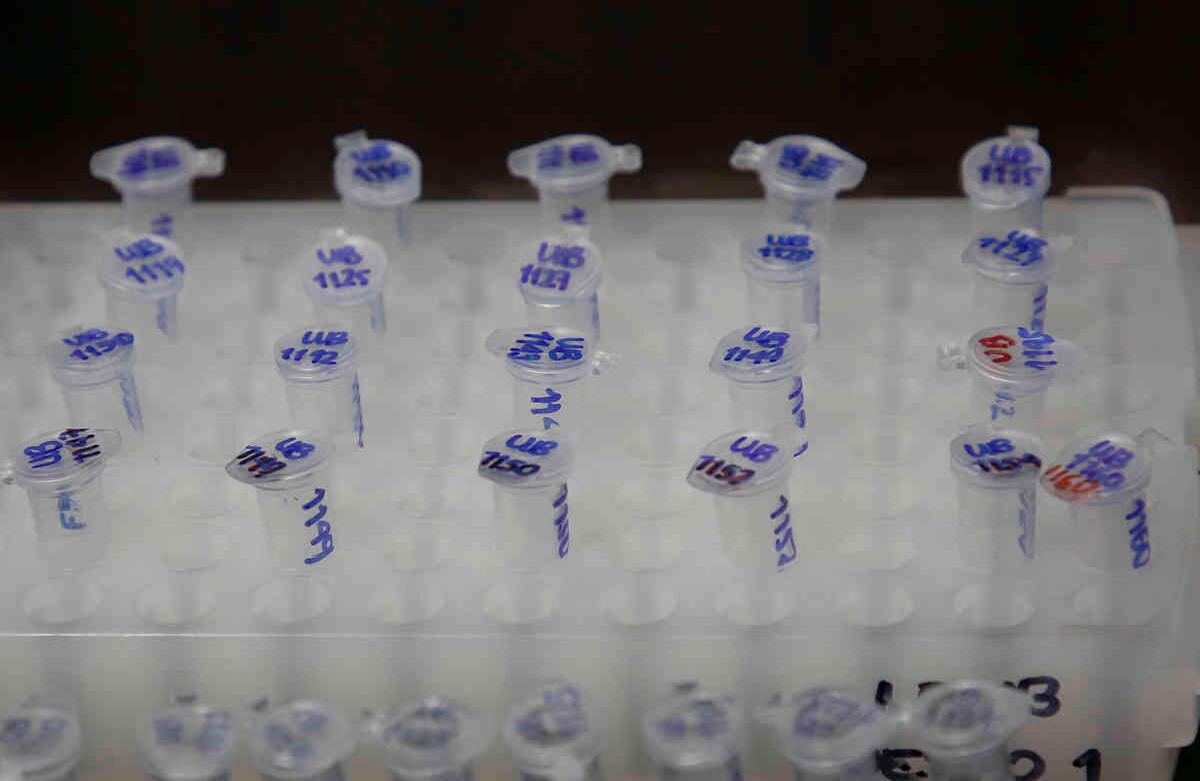 Este diagnóstico se hace a través de pruebas moleculares y cuyas muestras, hasta esta semana, eran tomadas a personas con factores de riesgo o sintomáticas. Cortesía Universidad El Bosque Foto: Guillermo Torres.