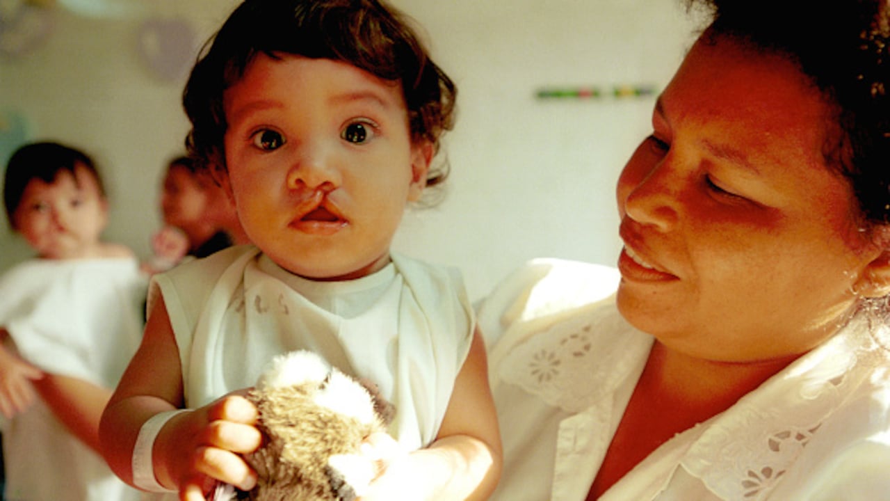 Los niños que lo experimentan afrontan numerosas dificultades para alimentarse, hablar y hasta escuchar, y pueden además tener un mayor riesgo de infecciones de oído y problemas dentales.