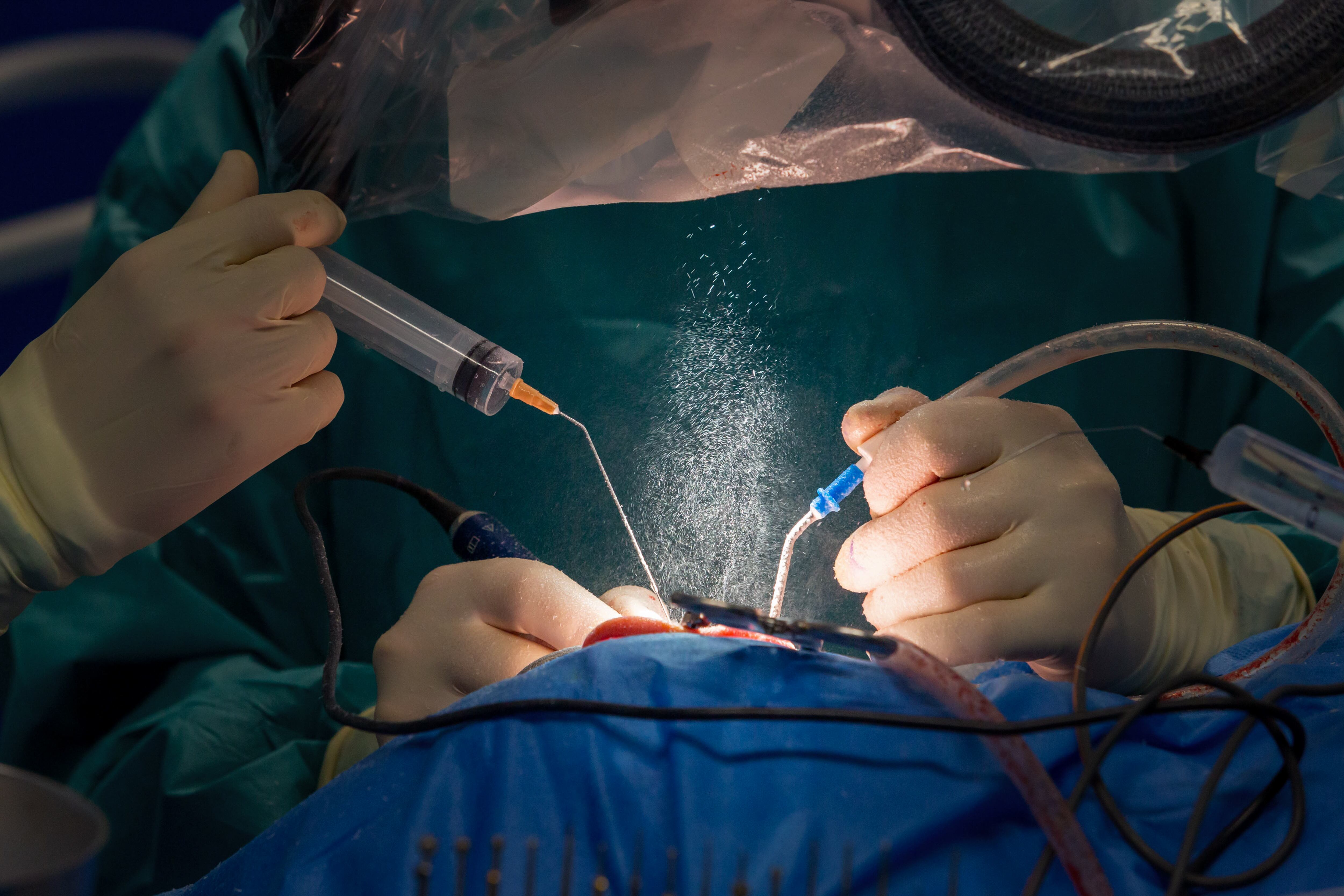 El doctor operaba a sus pacientes bajo los efectos de las drogas