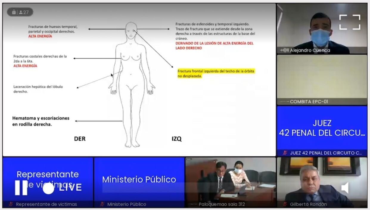 Caso Ana María Castro: Perito forense demuestra por qué sería una accidente de tránsito