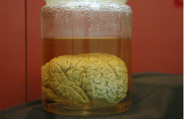 Uno de los cerebros más famosos de la colección es el de Burt Green Wilder, un profesor estadounidense de anatomía de la facultad de psicología de la Universidad de Cornell que fundó la colección en 1889. Foto: oddthingsiveseen.com 