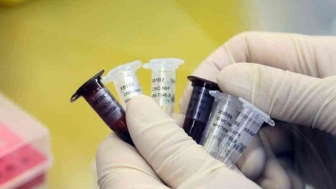 Se teme que ocurra un accidente en un laboratorio y que el virus se propague.