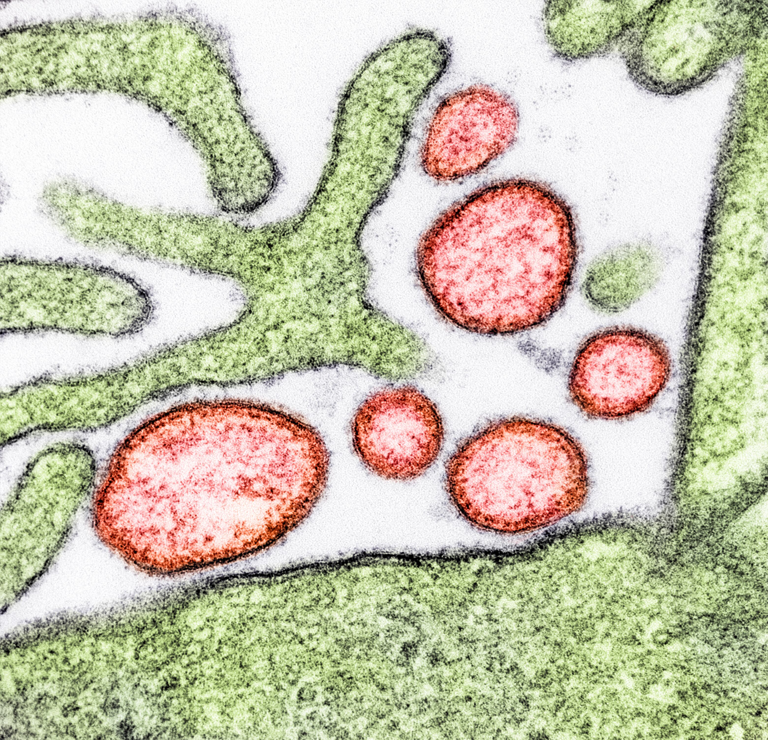 Micrografía electrónica de transmisión coloreada de partículas extracelulares maduras del virus Nipah (rojo) cerca de la periferia de una célula VERO infectada (verde).