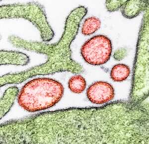 Micrografía electrónica de transmisión coloreada de partículas extracelulares maduras del virus Nipah (rojo) cerca de la periferia de una célula VERO infectada (verde).