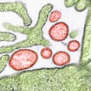 Micrografía electrónica de transmisión coloreada de partículas extracelulares maduras del virus Nipah (rojo) cerca de la periferia de una célula VERO infectada (verde).
