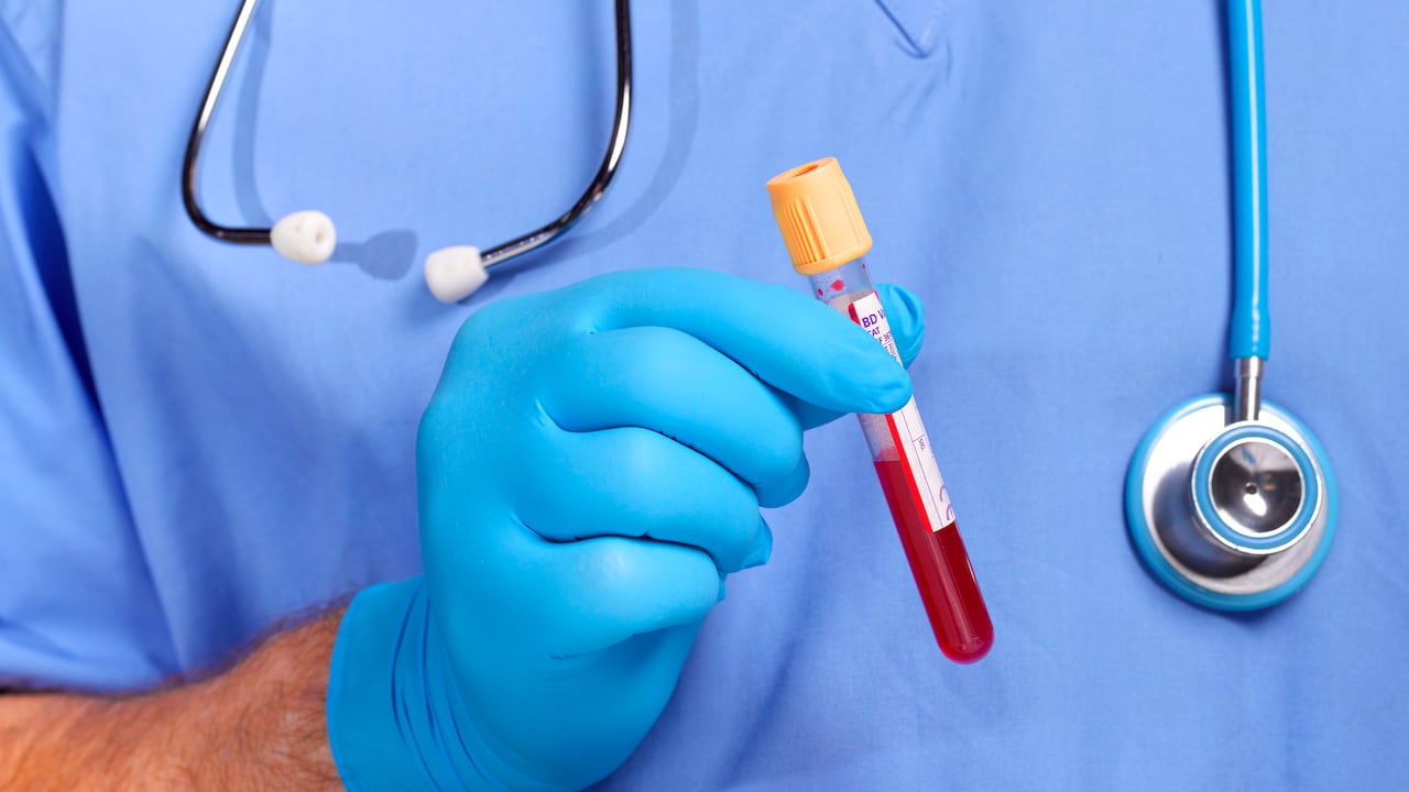 Un doctor haciendo exámenes de sangre- Imagen de referencia