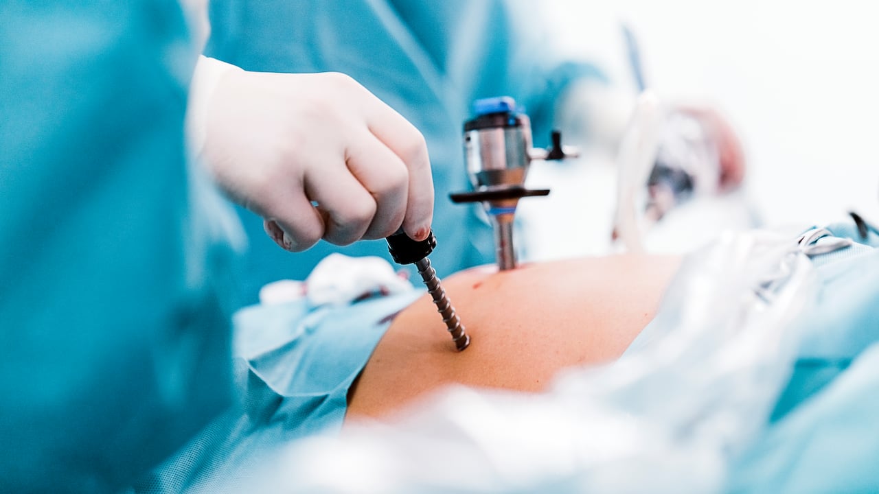 Uno de los métodos para adelgazar más eficientes es la cirugía bariátrica