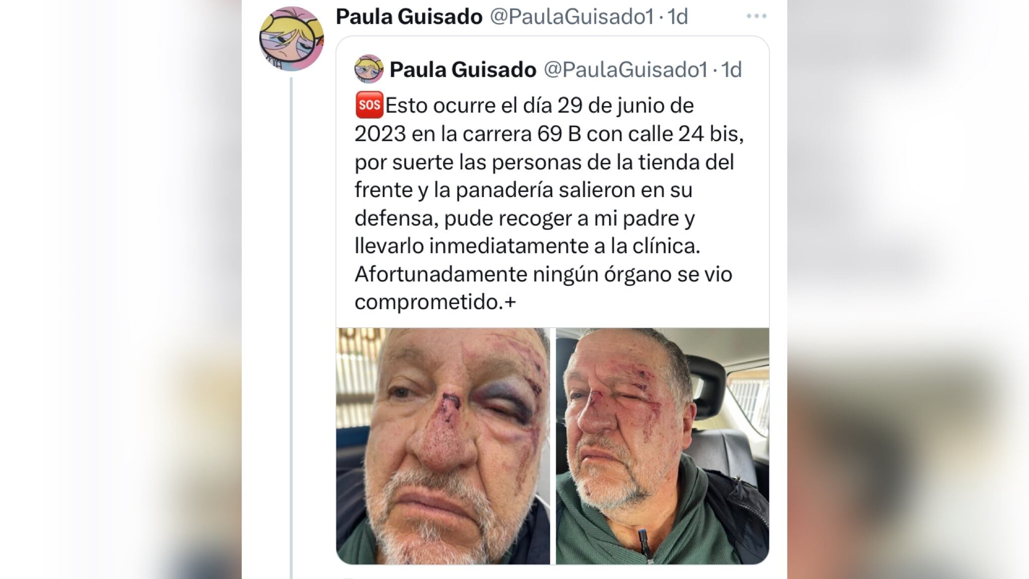 De acuerdo con Paula Guisado, "afortunadamente, ningún órgano se vio comprometido”.