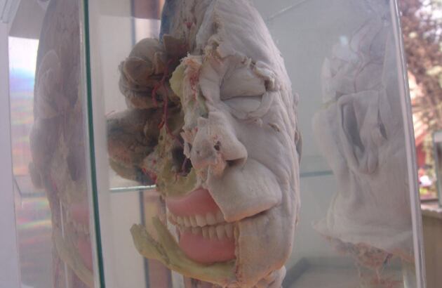 También hay cabezas enteras para ilustrar y enseñar sobre el espacio que ocupa el cerebro y cómo encaja en la cavidad craneal. 