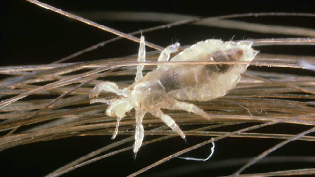 Si no se controlan a tiempo, los piojos pueden llegar a multiplicarse masivamente.