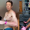 Rigoberto Urán ha tenido dos caídas en lo que va de 2022. Una en la Lieja-Bastoña-Lieja y otra en el Tour de Romandía