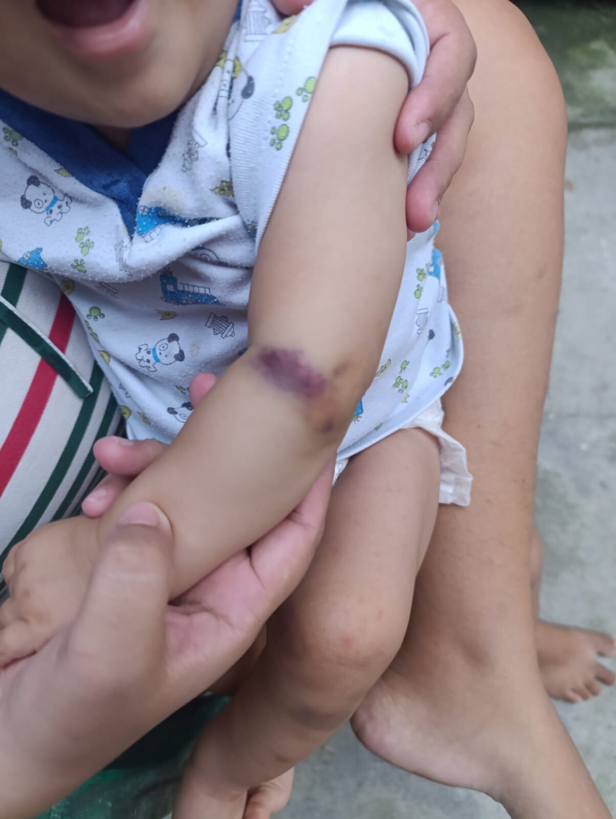 Hendrick Samuel tiene 17 meses y padece hemofilia A severa. Fue diagnosticado a los cuatro meses y no recibía su medicamento desde diciembre de 2025.