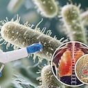 Tras la sospecha de un supuesto caso de peste neumónica en Rusia, se despertó el interés internacional por una enfermedad infecciosa