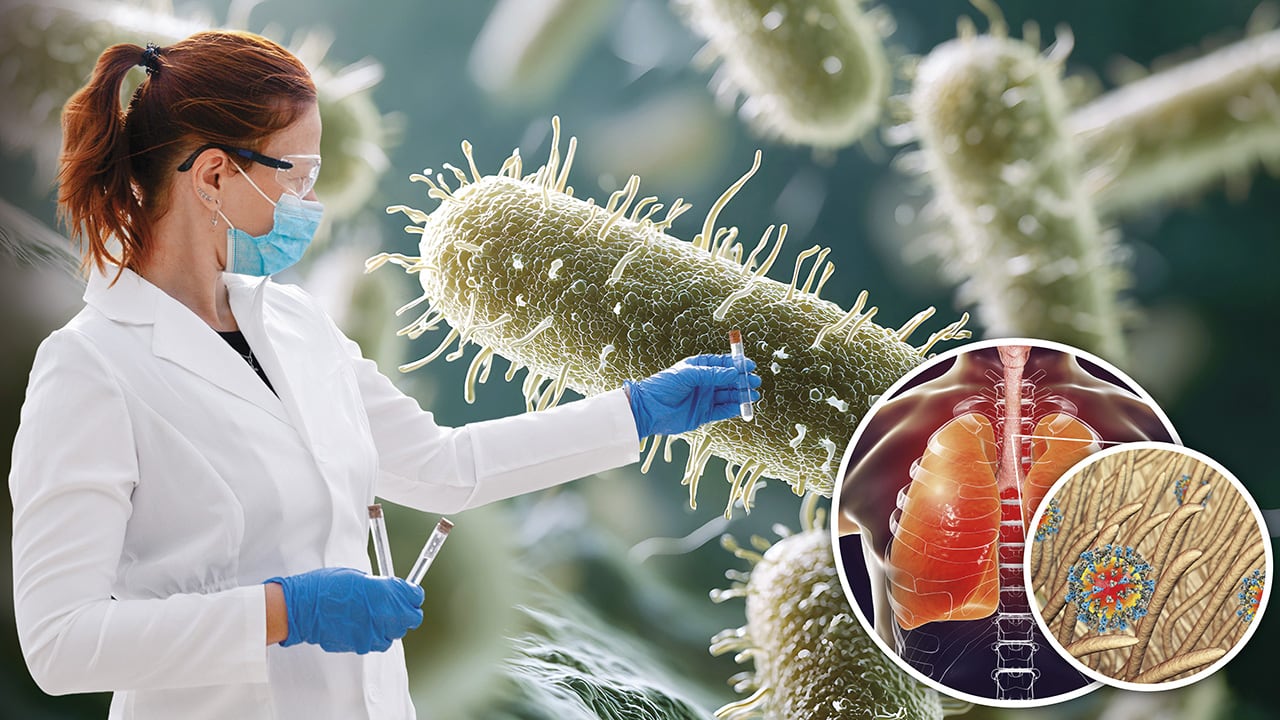 Tras la sospecha de un supuesto caso de peste neumónica en Rusia, se despertó el interés internacional por una enfermedad infecciosa.