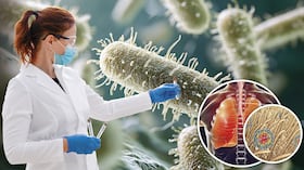 Tras la sospecha de un supuesto caso de peste neumónica en Rusia, se despertó el interés internacional por una enfermedad infecciosa