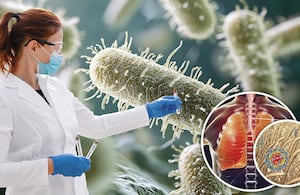 Tras la sospecha de un supuesto caso de peste neumónica en Rusia, se despertó el interés internacional por una enfermedad infecciosa