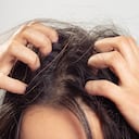 En algunos casos, la caspa puede provocar piquiña e irritación.