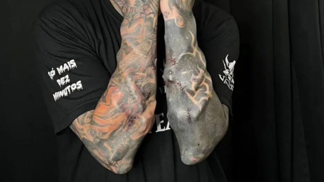 Modificaciones corporales de Víctor Hugo Peralta