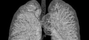 Los pulmones son los responsables del intercambio de gases. Estos extraen dióxido de carbono y agua de la sangre y los expulsan al exterior, 