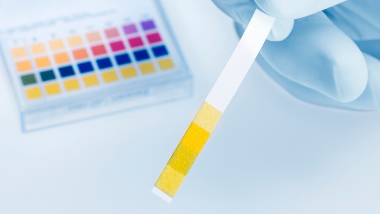 El color de la orina puede indicar si la persona está bien o padece algún tipo de afección .