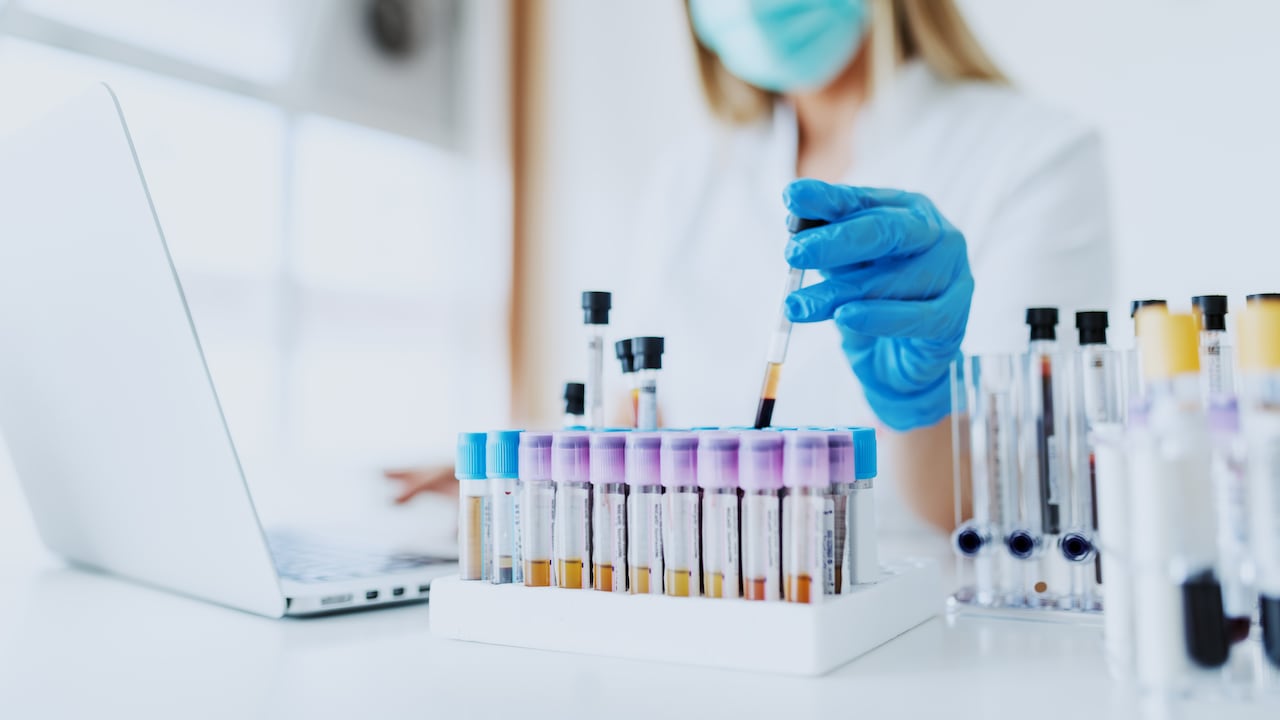 Imagen de referencia, no corresponde al caso en mención.