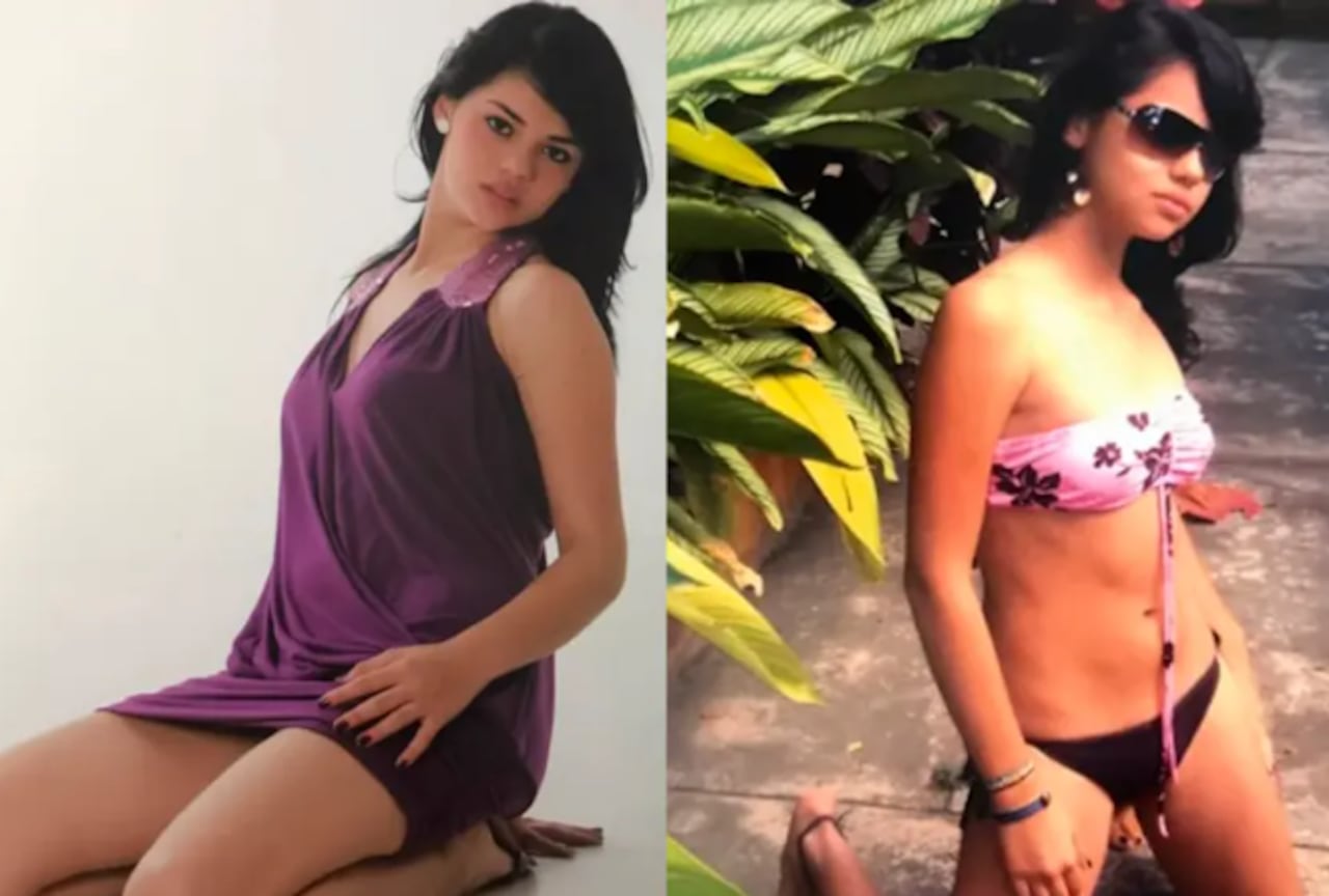 Cómo se veía La Segura antes de hacerse cirugías