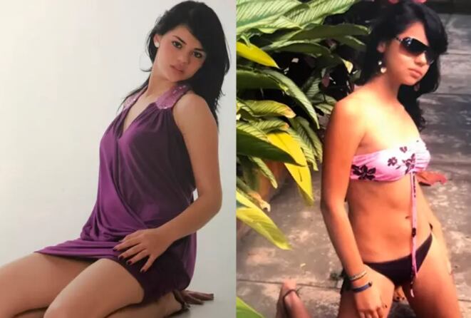 Cómo se veía La Segura antes de hacerse cirugías