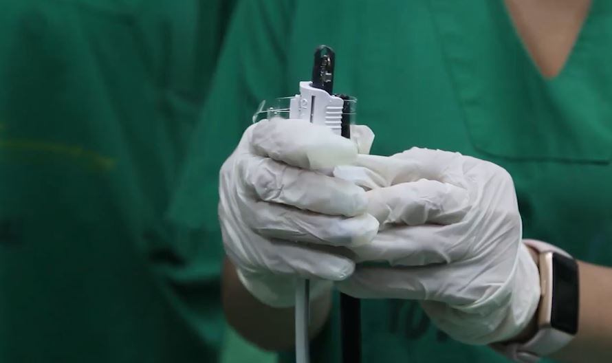 En esta intervención, se inserta por la garganta el dispositivo con el que se sutura el estómago para dejarlo más pequeño.