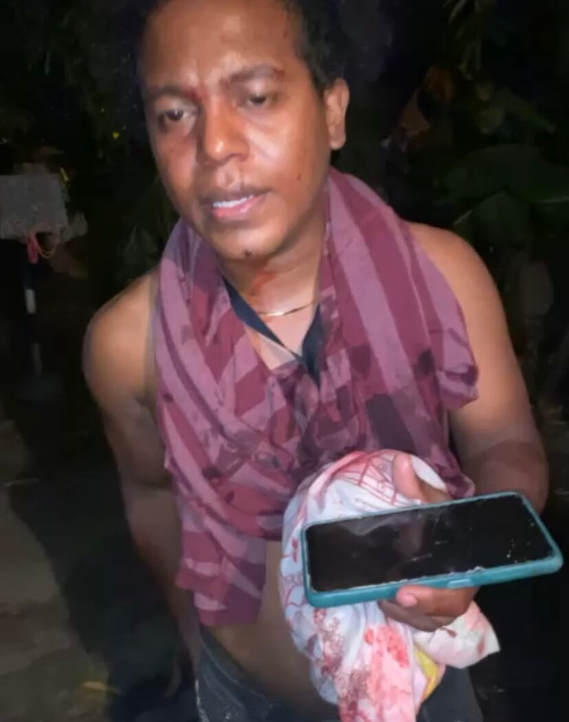 Denuncia de agresión.