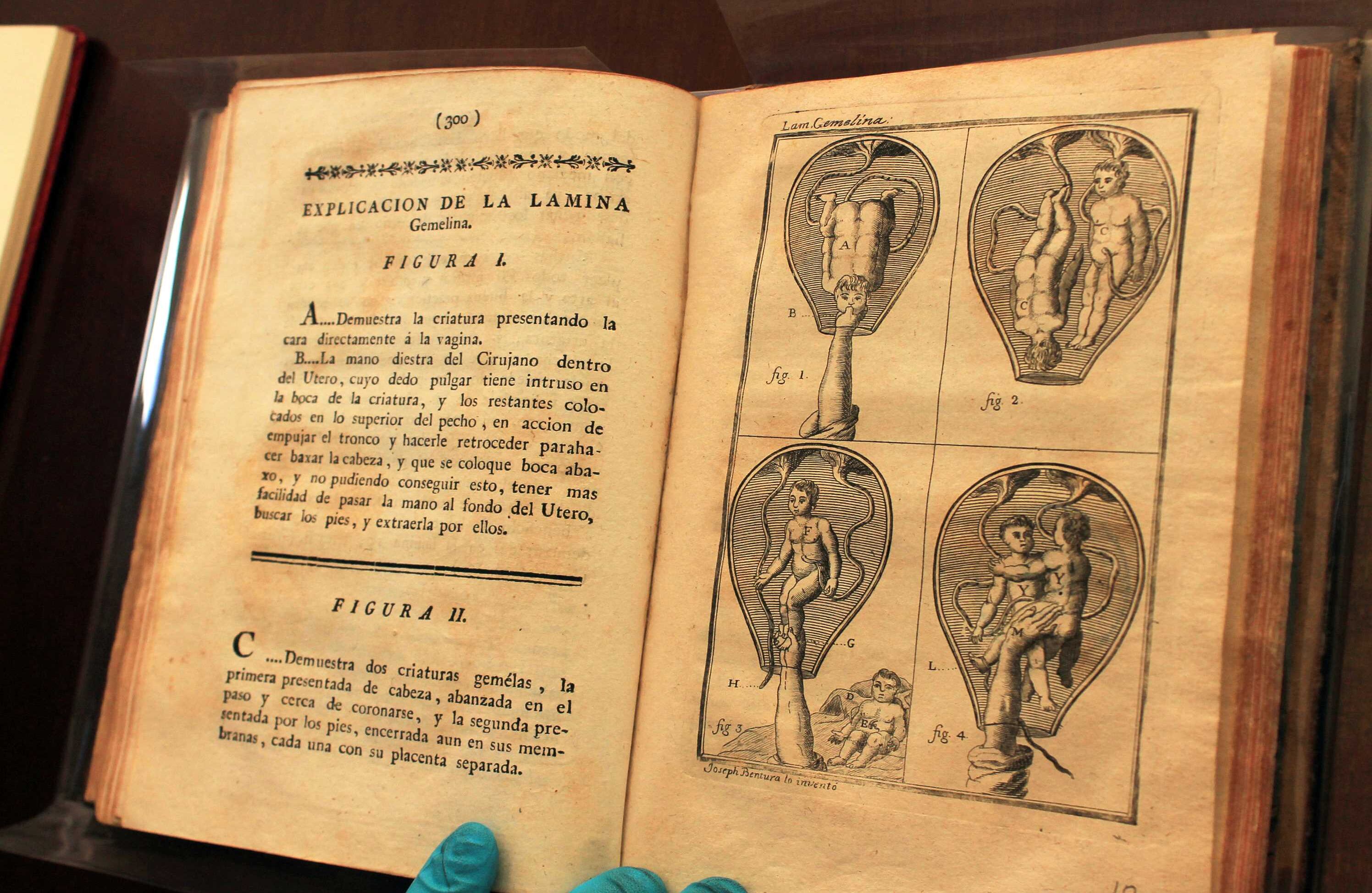 ‘Preceptos generales sobre las operaciones de los partos’ de José Ventura Pastor (1790). Daba instrucciones sobre cómo asistir un parto. En ese tiempo la ciencia estaba entre lo fáctico y la fantasía. Foto: Álvaro Tavera.