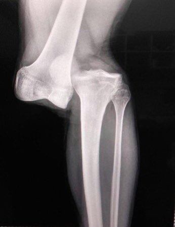 Radiografía Luciano Sánchez