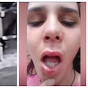 Caso de intolerancia: mujer fue brutalmente agredida tras denunciar a sus vecinos por ruido