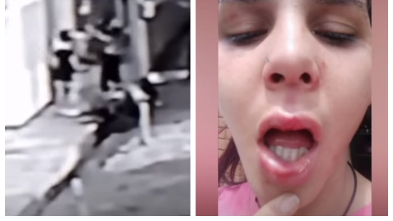 Isabel Goncalves fue la más afectada en la golpiza. Sufrió heridas de gravedad en su rostro.