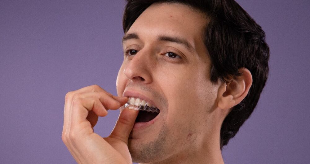 Ortodoncia invisible Wizz Colombia