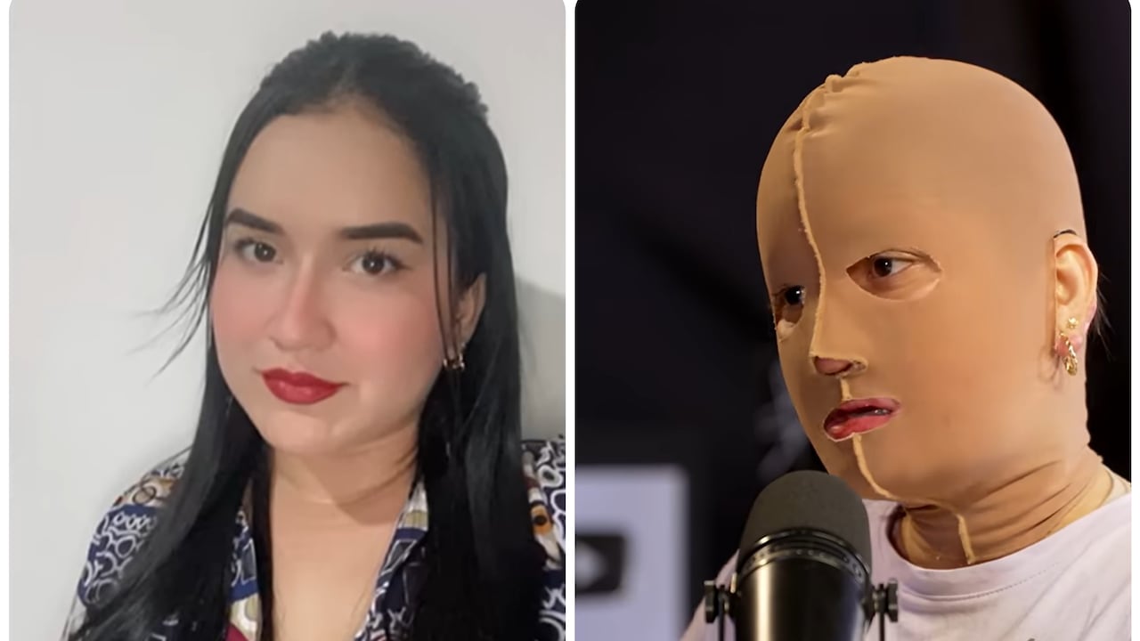 María Alejandra Ortiz, víctima de un ataque con fuego.