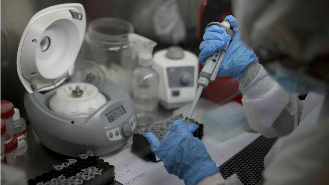 Coronavirus en Colombia: cifra de fallecidos llegó a 16.968/Foto: AP