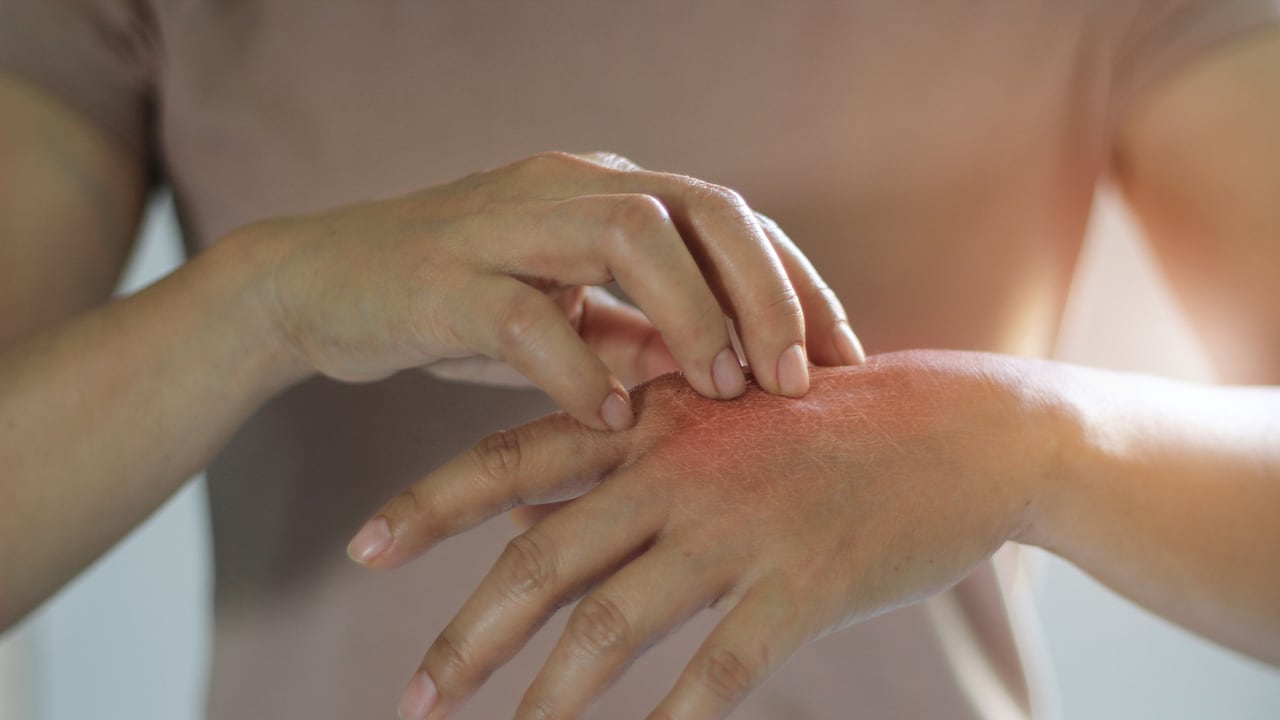 Esta es la verdad detrás de los mitos más comunes sobre por qué algunas personas atraen más a los mosquitos.
