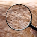 El hombre fue a un hospital después de que empezara a perder la sensibilidad en los dedos de sus pies.