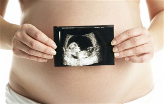 La atención de mujeres embarazadas se verá afectada en Candelaria, Valle del Cauca. 